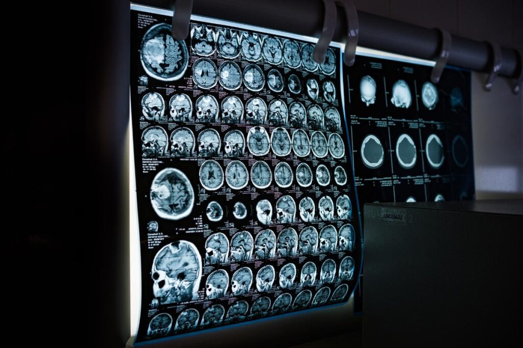 ¿Qué estudia la neurociencia?